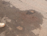 Yaoundé : des hanches coupées retrouvées au milieu de la route