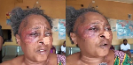 Affaire de disparition de s3xe : La version du patron de la police de Bamenda