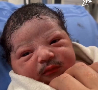 Un bébé différent