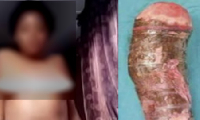 Elle est arrivée aux urgences avec un manioc coincé entre les cuisses