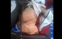 Bébé agressé mortellement
