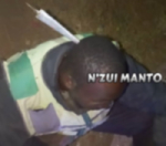 Un bensikineur survit à un couteau planté dans sa tête par les bandits