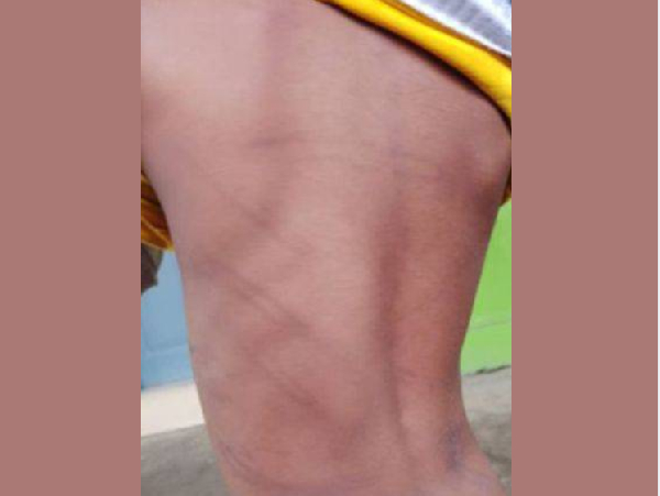 L'enfant a été copieusement maltraité