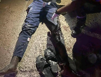 L'homme a été poignardé à la cuisse