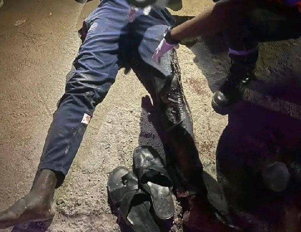 L'homme a été poignardé à la cuisse